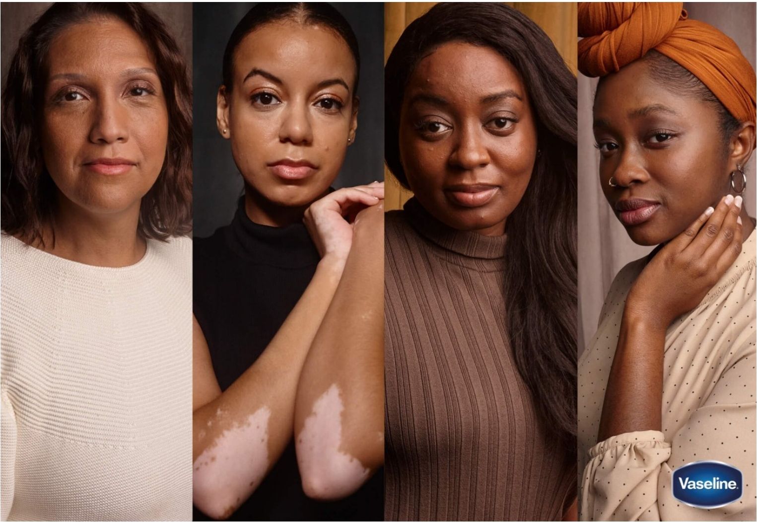 Vaseline's See My Skin campaign — representing diverse skin tones and conditions including vitiligo (Vaseline, 2023).